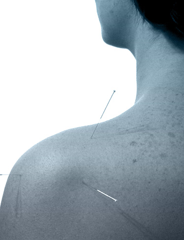 To book an appointment or a free consultation contact Physioactive